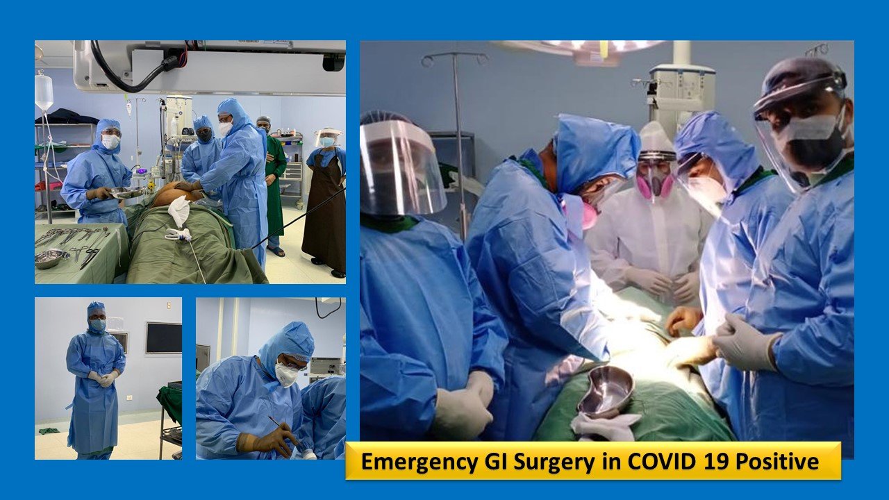 COVID 19 surgery (1)