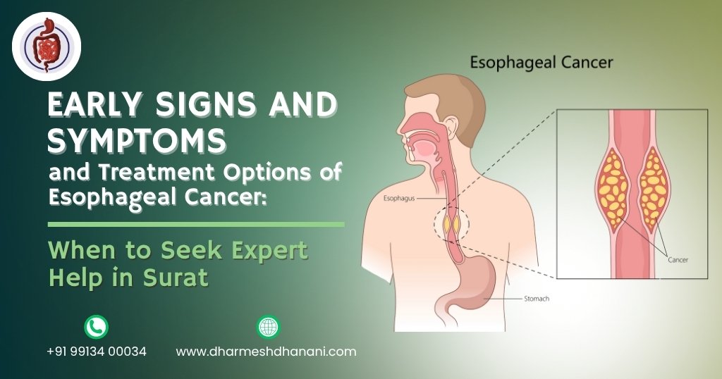 Early Signs and Symptoms and Treatment Options of Esophageal Cancer: When to Seek Expert Help in Surat