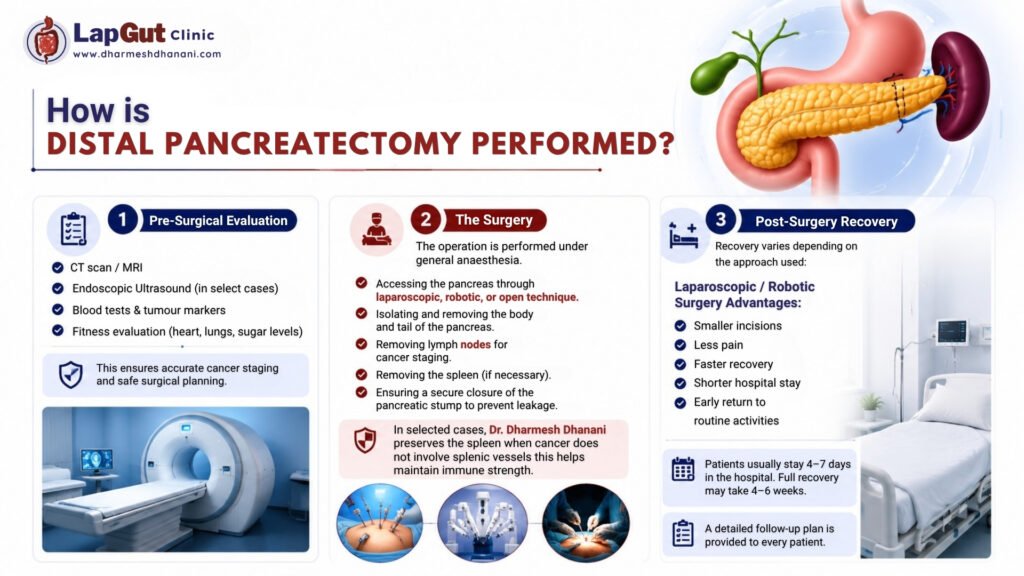 How Distal Pancreactomy Performed