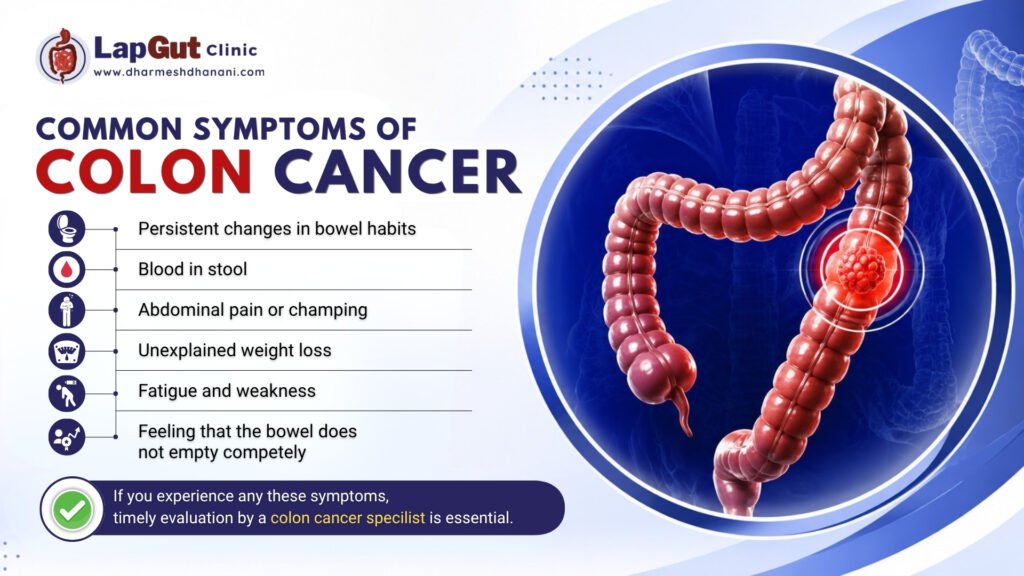 Common Symptoms of Colon Cancer - Dr Dharmesh Dhanani